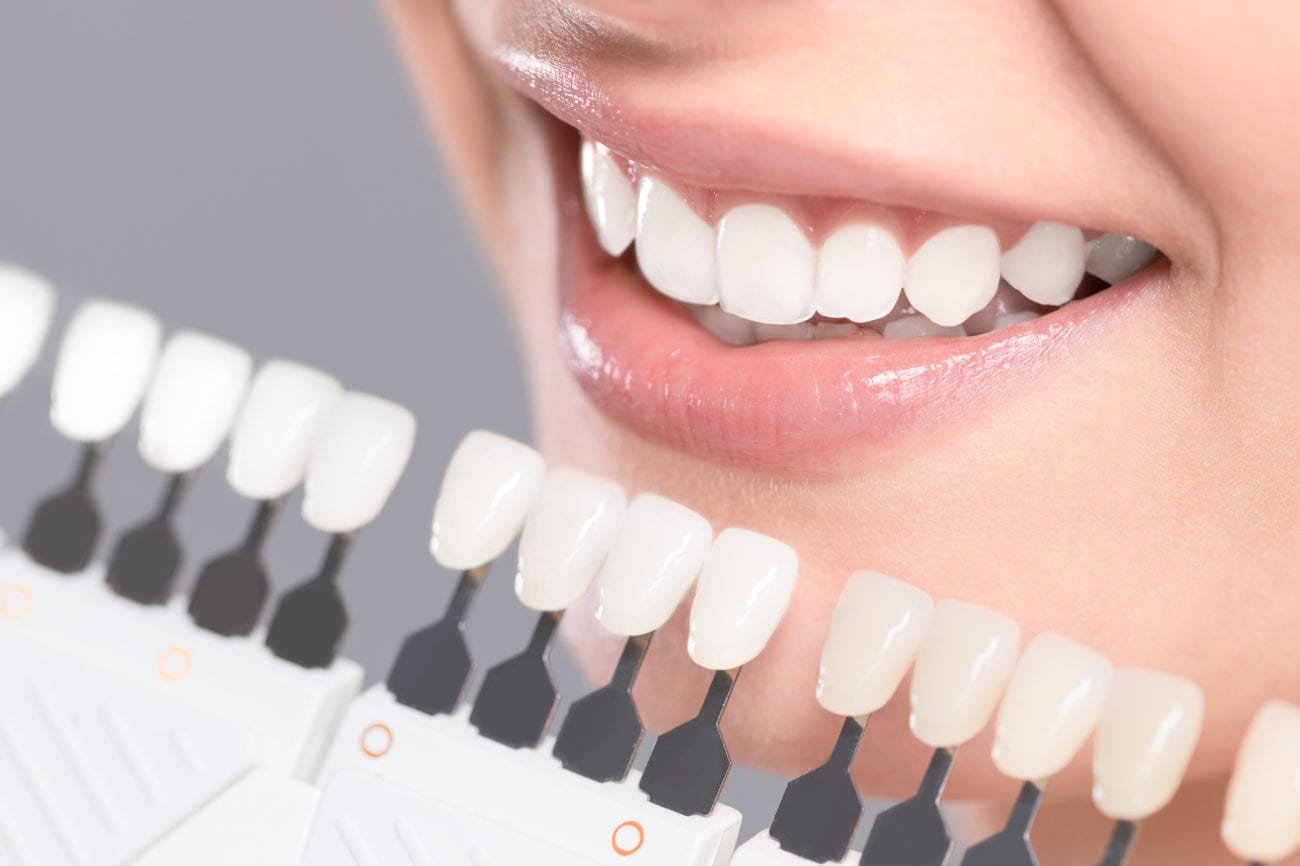 teeth whitening treatment in Skokie Illinois