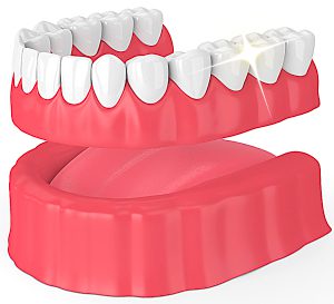 Full Dentures in Skokie, Illinois