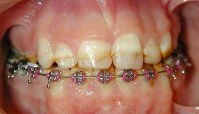 Before Cosmetic Dental Care in Skokie, IL