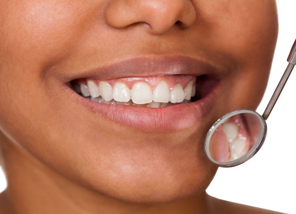 The Damage of Dental Erosion